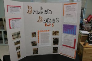 Reut's project board, titled "Broken Bones."